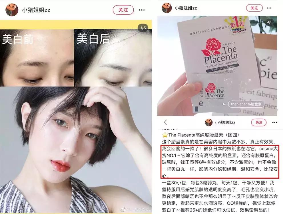 日本的美白针,日本最强美白针