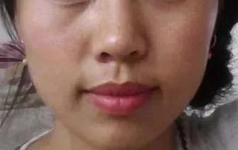 吸黑头神器去粉刺角质收缩毛孔,皮肤清洁收缩毛孔黑头角质