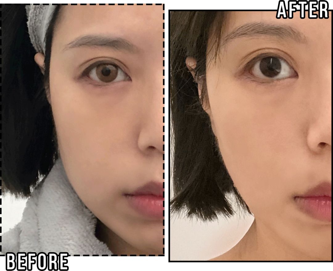 花3000块做一次皮肤护理，我后悔吗？