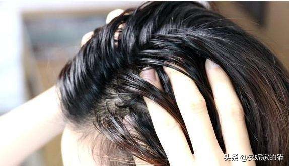 冬天头油夏天头屑,头油头屑异味重怎么办