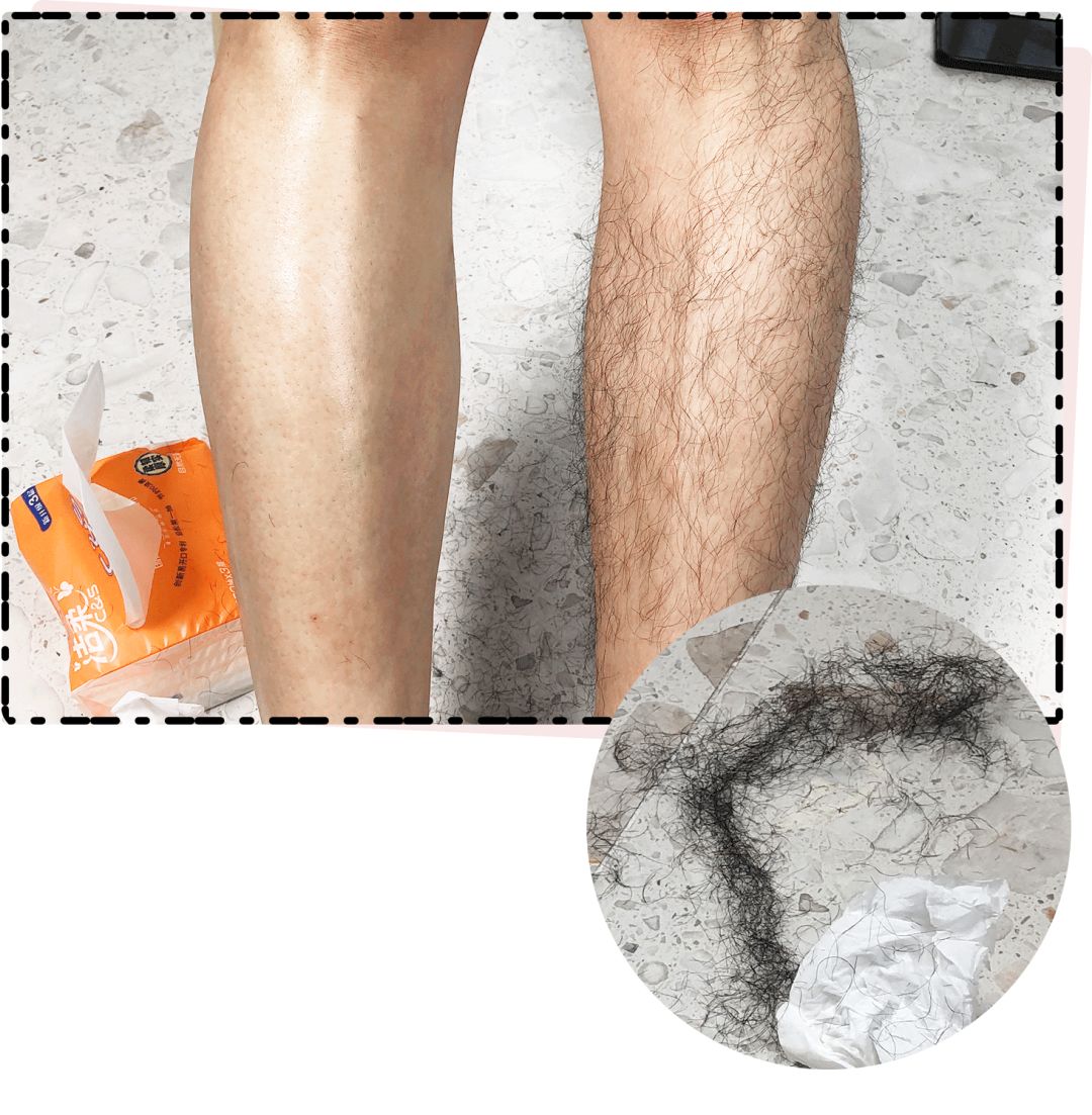 网红脱毛仪器家用评测,网红脱毛仪哪个好用又便宜