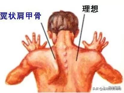 沉肩的时候肩胛骨下角翘起怎么办,肩胛骨翘起真的可以改善吗