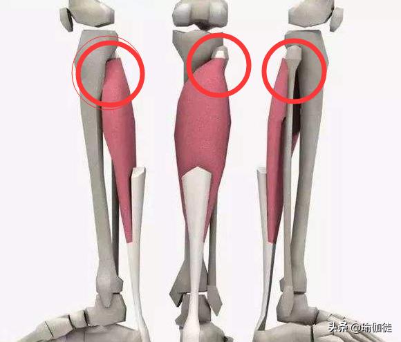 什么是膝盖过度伸展（膝盖超伸）？在瑜伽中怎么改善和正位？