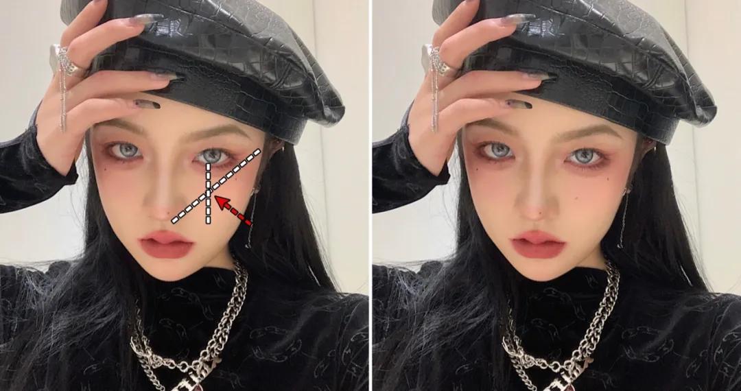 全脸点痣变美,点痣能变美吗