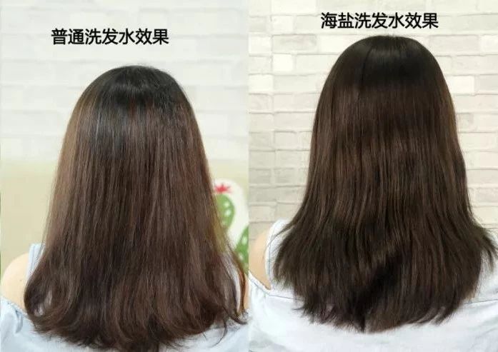 头发易出油头皮多怎么回事,头皮上有螨虫头发掉怎么办