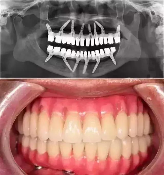 为什么总逃不过命运,为什么每个人都逃不掉命运的捉弄