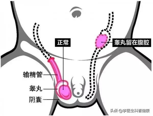 泌尿外科那点事儿公众号,泌尿外科那些事儿
