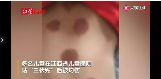 女儿差点被网购的药贴毁容