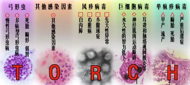 孕前体检会检查艾滋病吗,夫妻孕前体检必查项目表