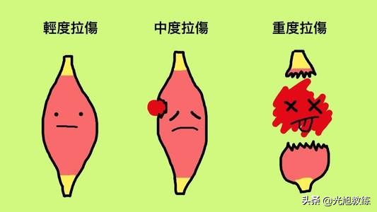 怎么知道是不是肌肉拉伤,肌肉拉伤的说说