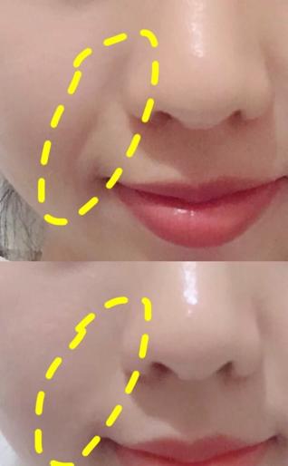 脸部什么纹路最显老,脸上显老的两条线