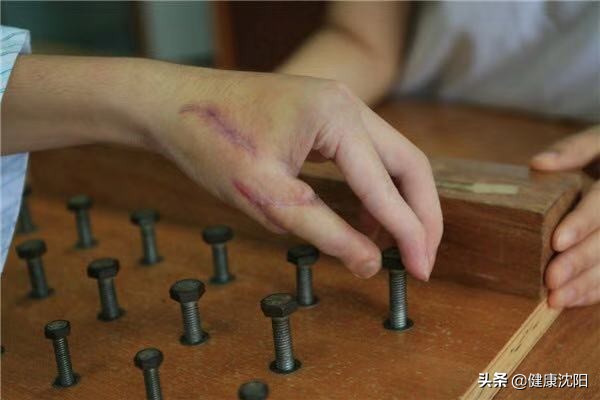 手指头被机器绞伤吃什么助于恢复,脚趾头被机器绞烂了怎么处理