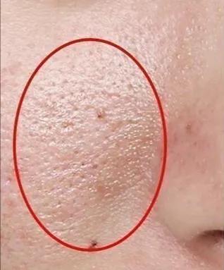 毛孔能放芝麻,每次自拍,磨皮都要开到最大,别看了!说的就是你