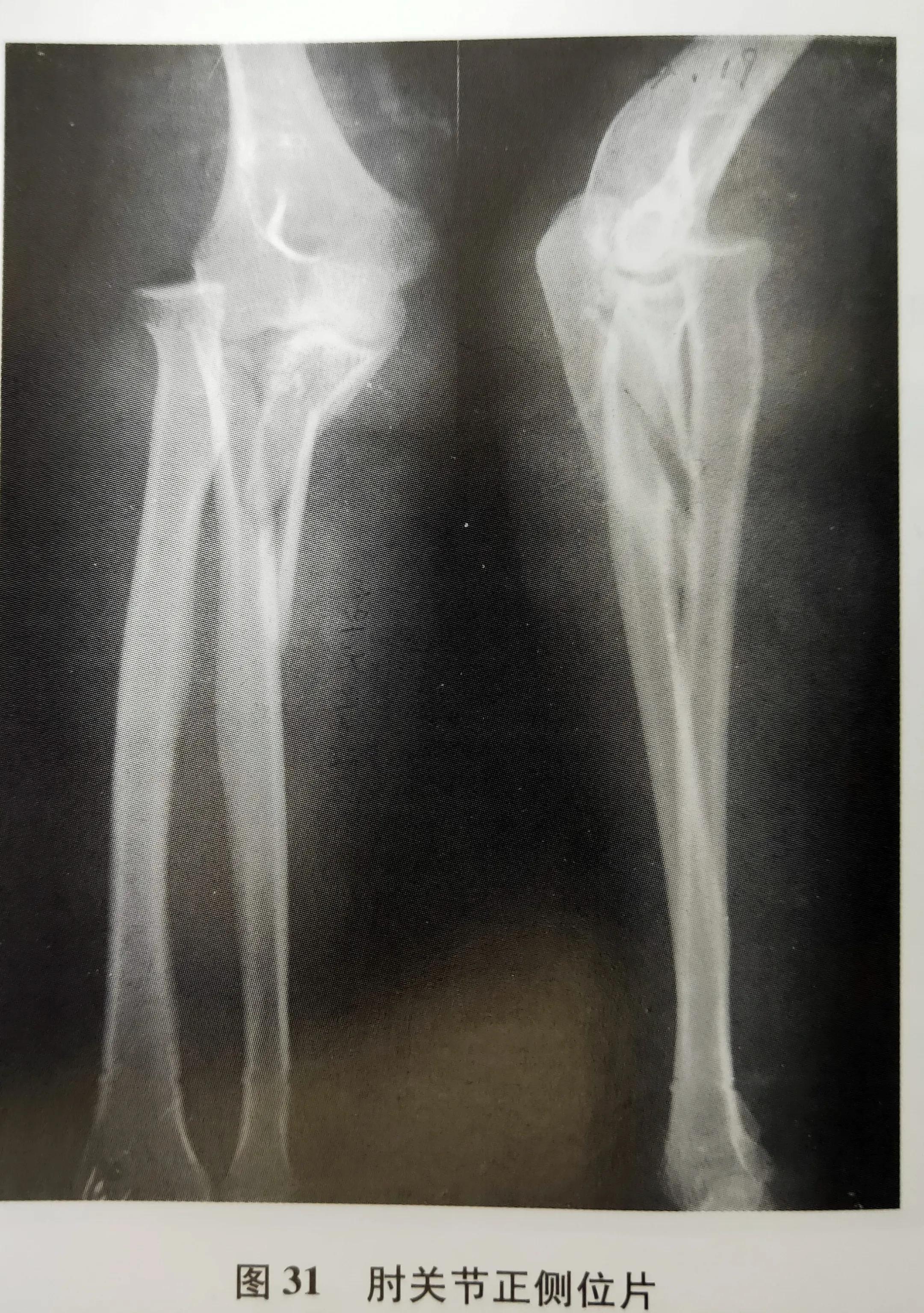 学习《X线读片指南》第一节X线成像的基本原理