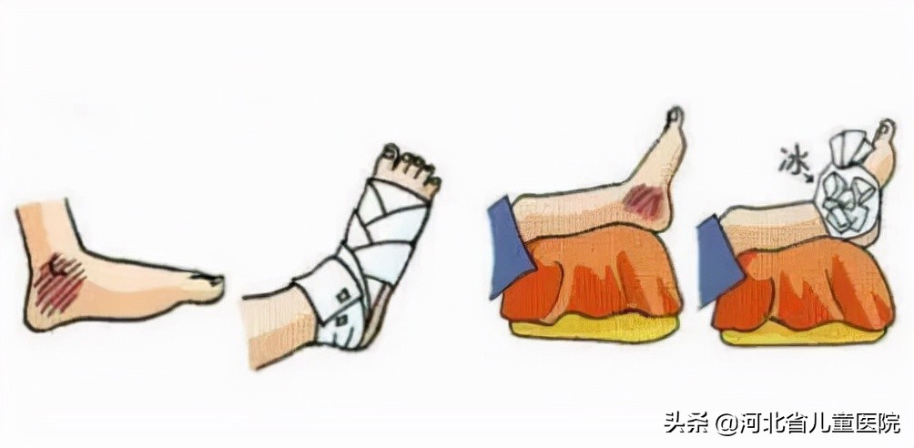 孩子的脚被孩子咬怎么处理,电动车绞住孩子脚怎么办