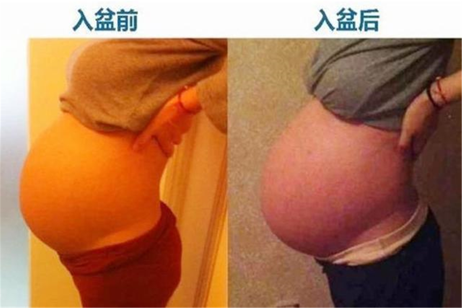 孕晚期下腹痛是什么原因,孕晚期感觉腹痛是要生了嘛