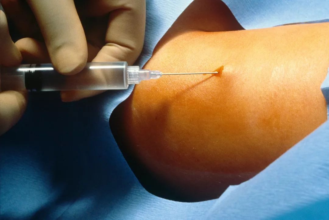 在美国做手术的体验,在美国做妇科手术