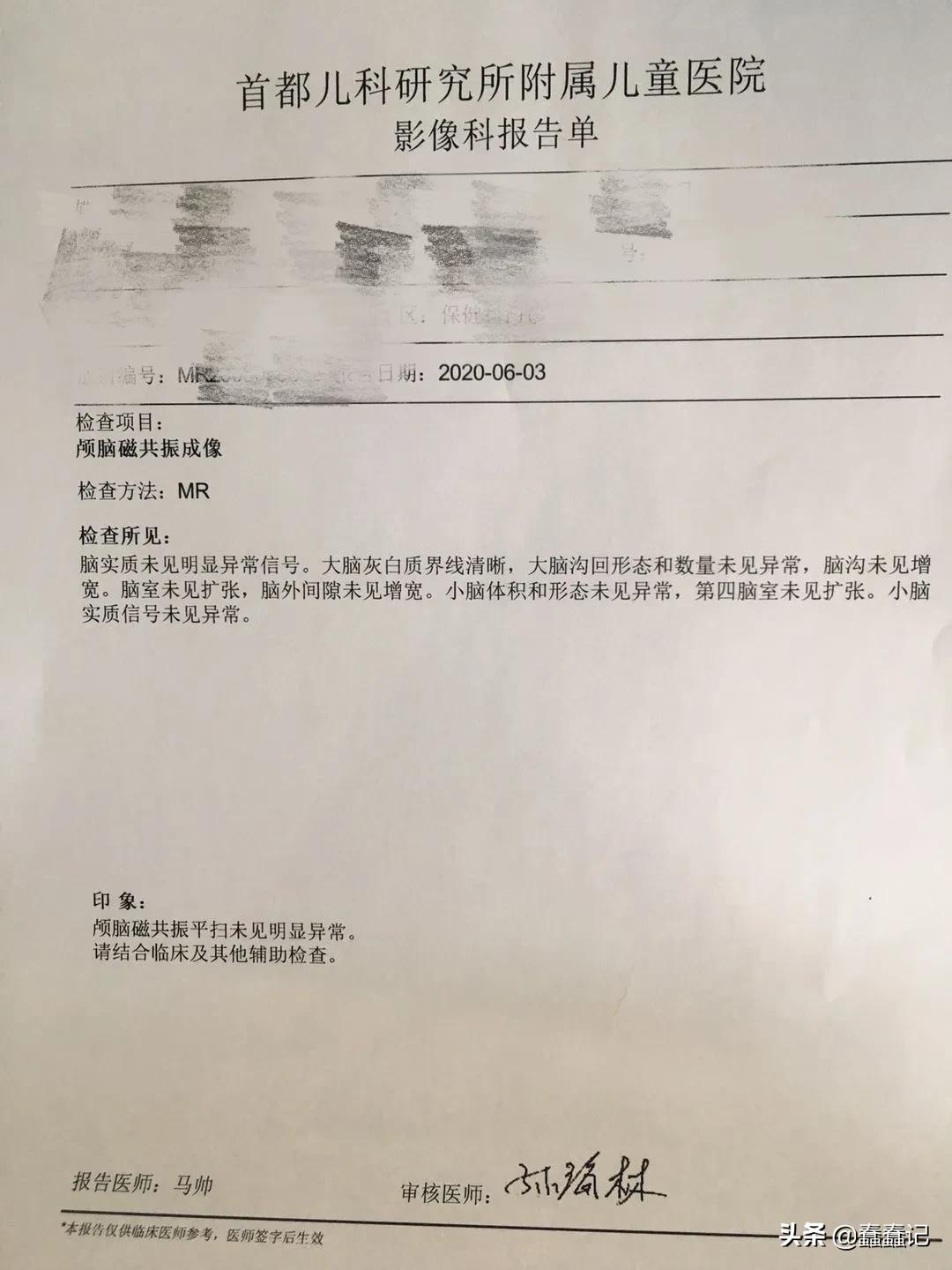 七个月检查宝宝头偏小,7个月婴儿头围40做核磁共振正常