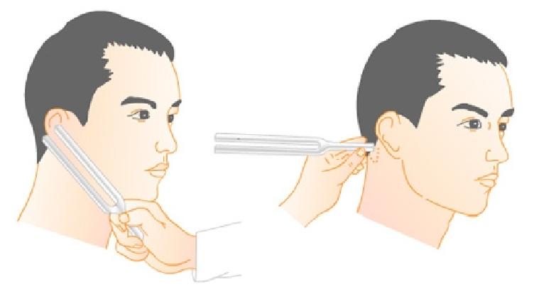 面神经炎治疗自述,面神经炎科普视频