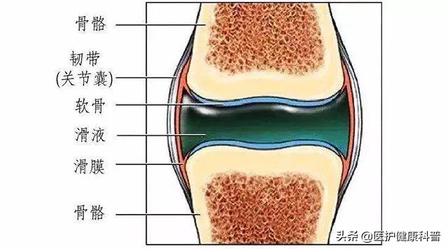 膝盖反复肿是怎么回事,膝盖滑膜炎肿了应该如何按摩