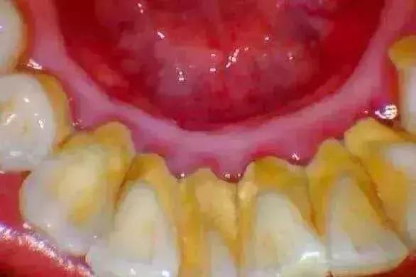 为什么总逃不过命运,为什么每个人都逃不掉命运的捉弄