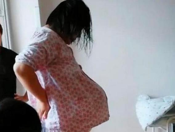 为什么今年怀孕的孕妇孕吐很严重,孕妈怎么熬过孕早期孕吐啊