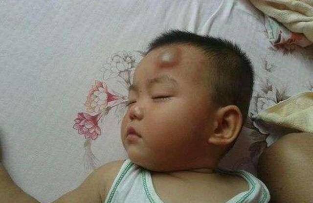 宝宝磕到头去医院查什么,小孩不小心磕到头一定要去医院吗
