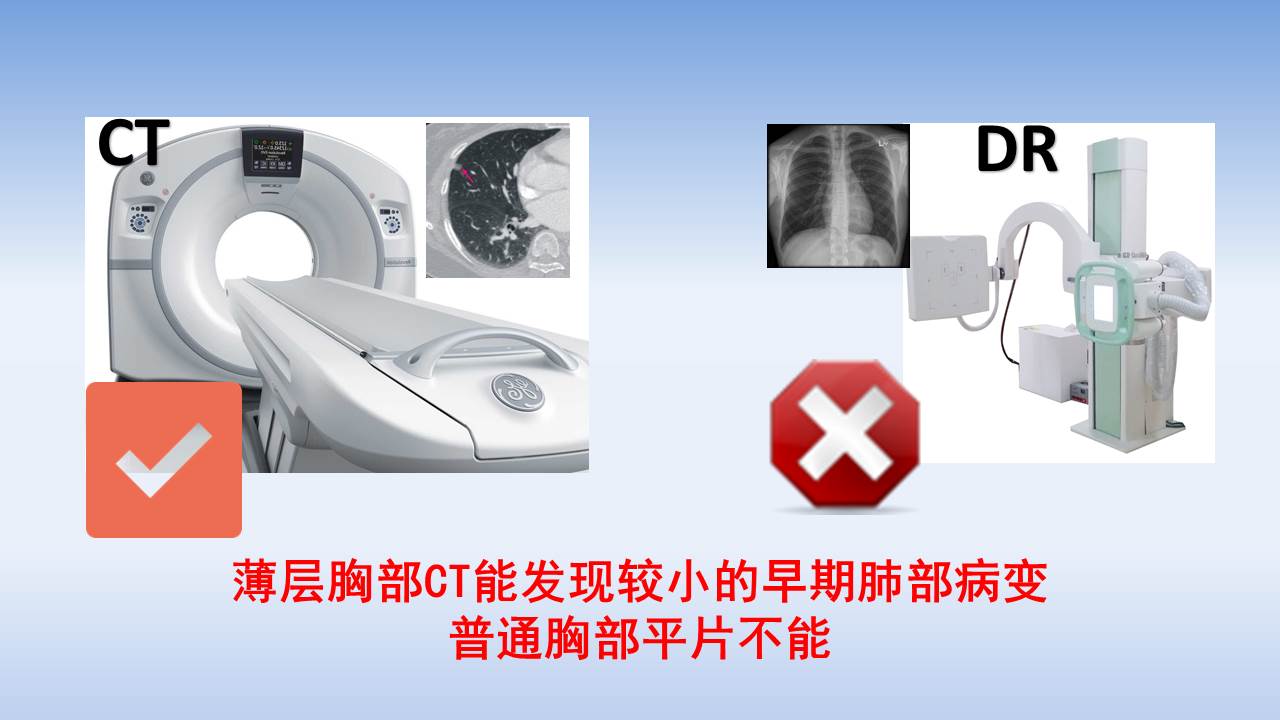 知道自己有肺结节度日如年,渡过肺结节的劫