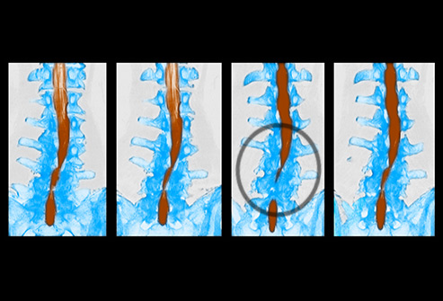 身体有病胯骨先知,身体有病双腿先知