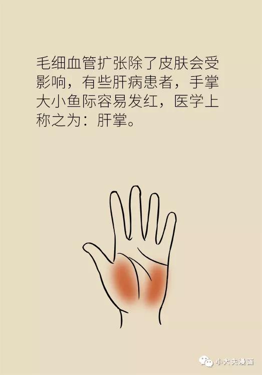 经常洗牙为什么也有牙菌斑,一洗牙牙龈出血是咋回事