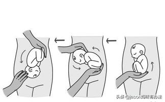孕中期产检，孕妈发现胎儿是臀位怎么办？试试这3招扭转胎位