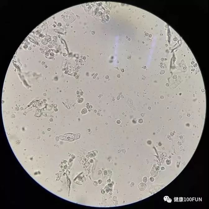 女人那个地方痒是怎么了,女性哪里痒