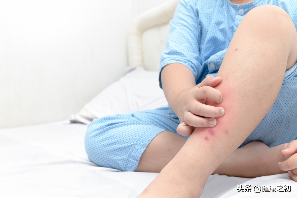 被蚊子和臭虫咬了用什么药好得快,如何判断是被蚊子咬还是被臭虫咬