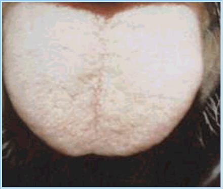 望舌知病实操完整版,教你看舌辨病