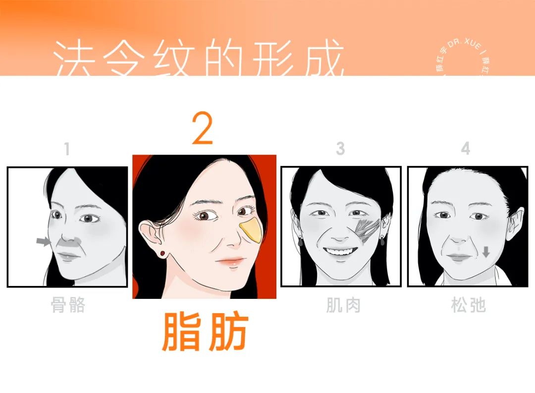 脾胃好了法令纹会改善吗,面部瑜伽能改善法令纹吗