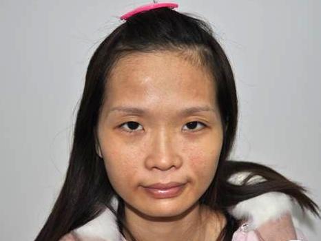 皮肤没有光泽两招改善,额头皮肤粗糙没光泽