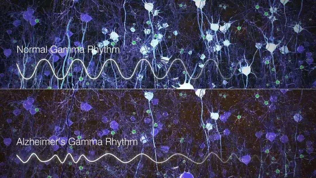 神奇的“光治疗”——药物研发窘境下阿尔兹海默症的治疗探索