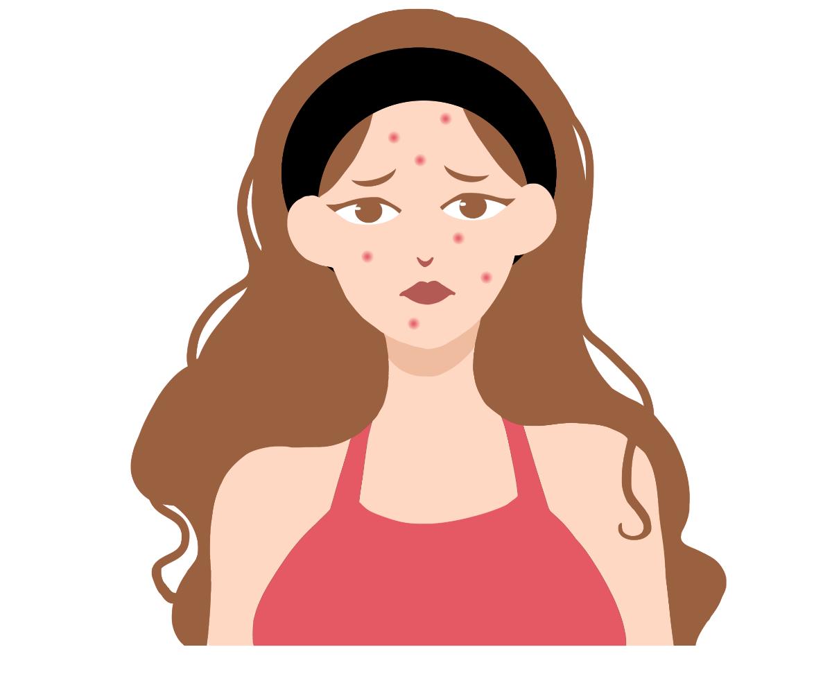 脸上有痘拍婚纱怎么办,要拍婚纱照了脸上长痘了怎么办