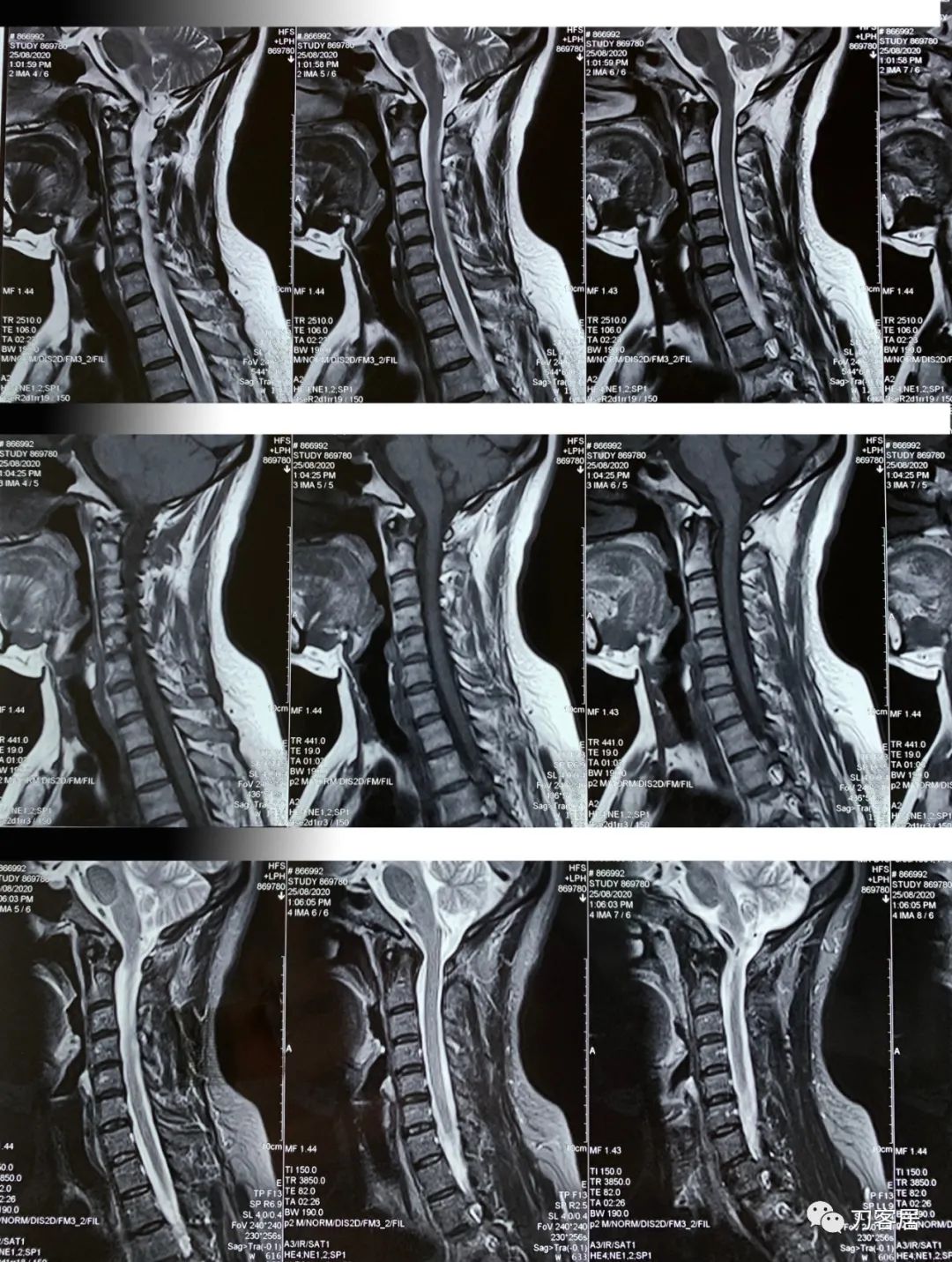 我的门诊病历,我的门诊
