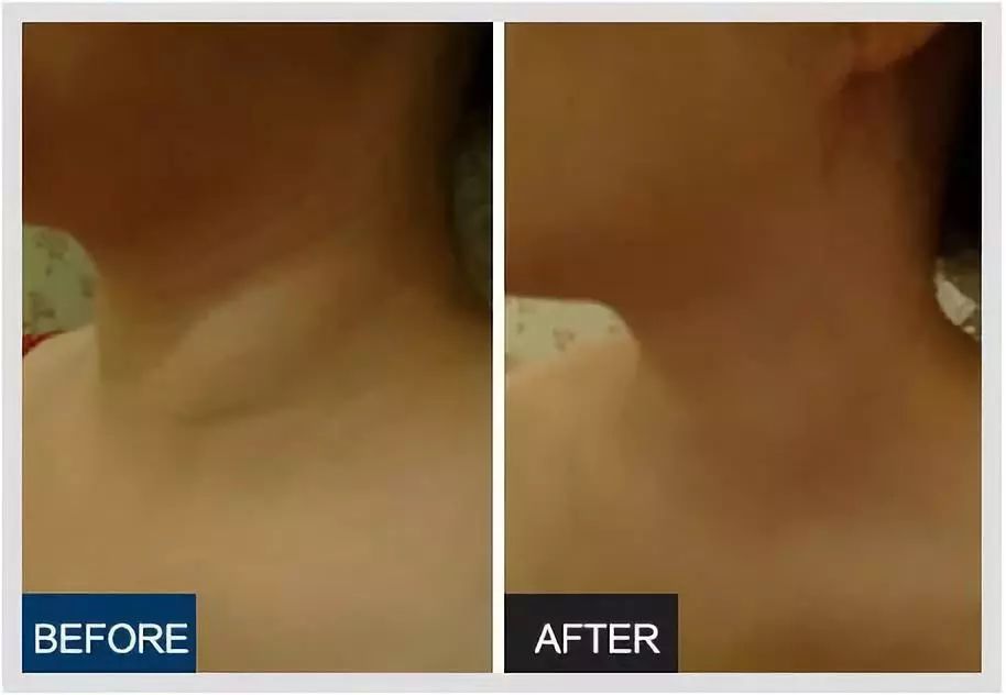 45岁金喜善素颜,金喜善冻龄秘密