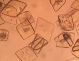 看尿酸化验单,检查尿酸600以上的图片