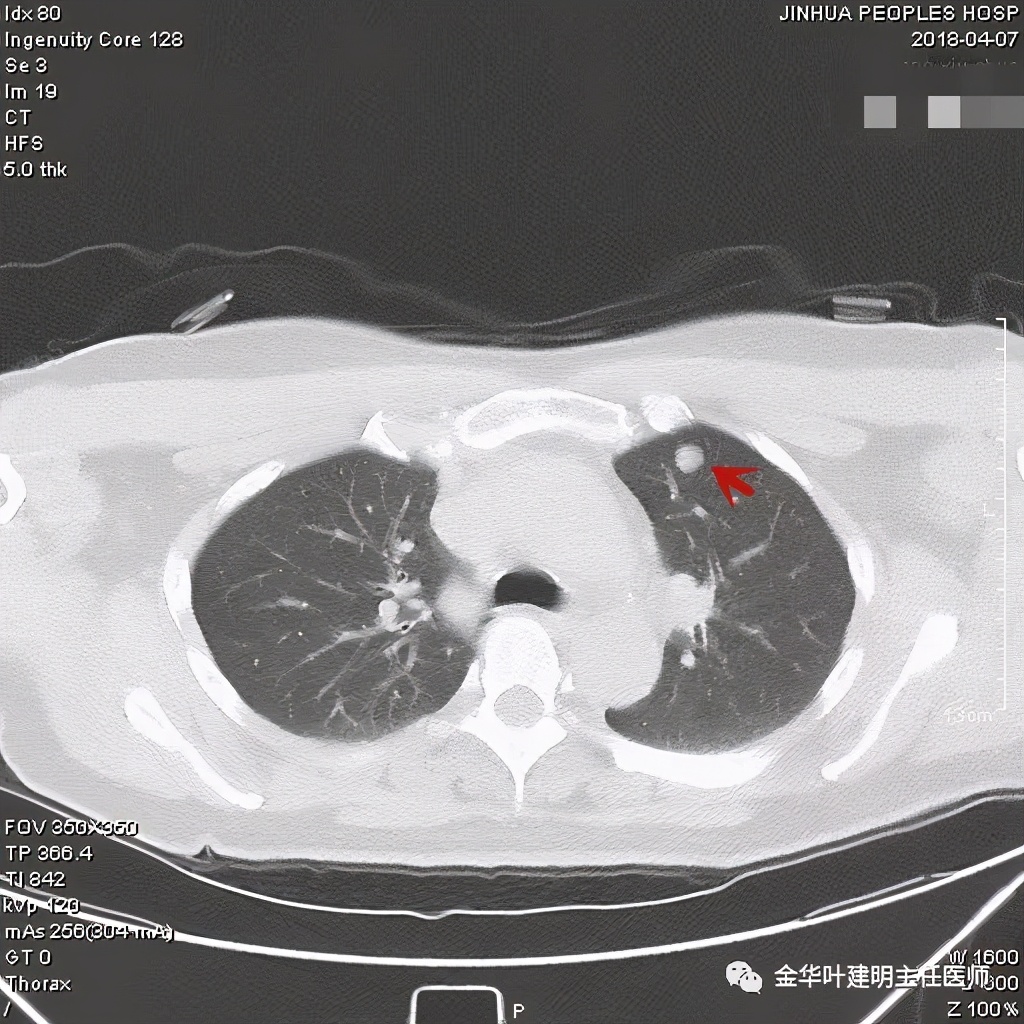 误诊报告图片,误诊案例及案例分析