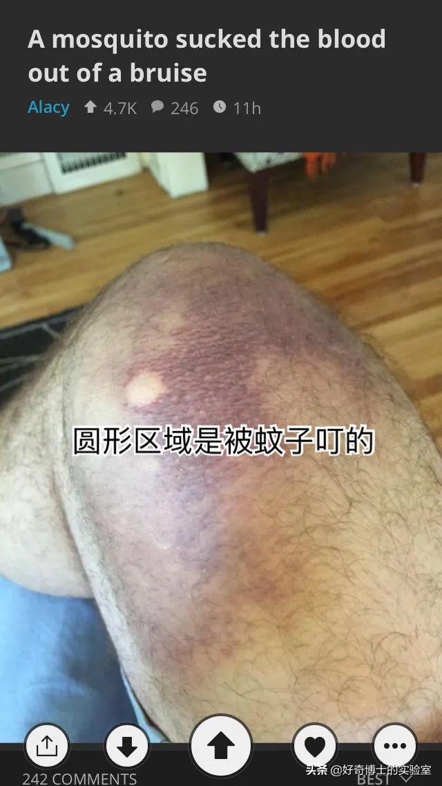 为什么有人拉屎会流眼泪,拉屎流眼泪是病吗