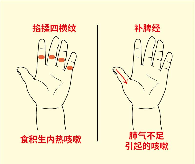 孩子长期咳嗽反反复复就是不好,孩子咳嗽反反复复中药调理