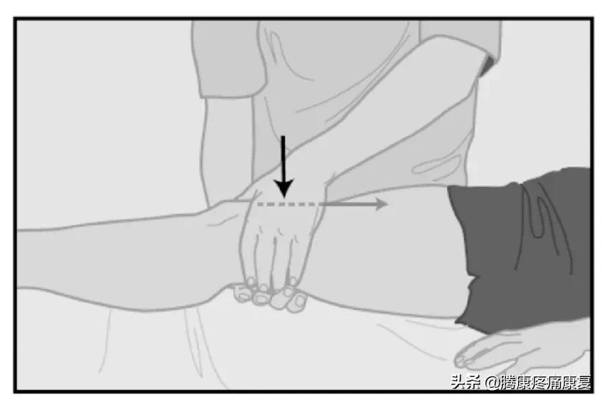 髌股关节疼痛综合症的检测方法,髌股关节疼痛综合征