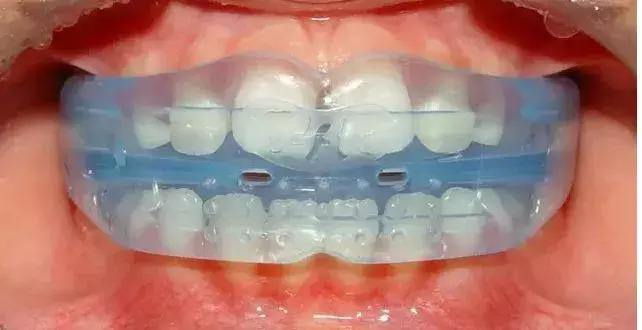 helen齿科,helen齿科中心怎么用