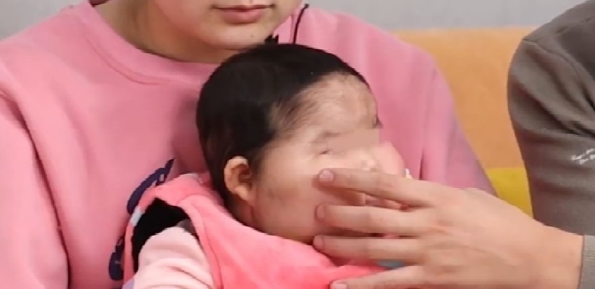 是不是消字号面霜都有激素,消字号面霜用了会怎样