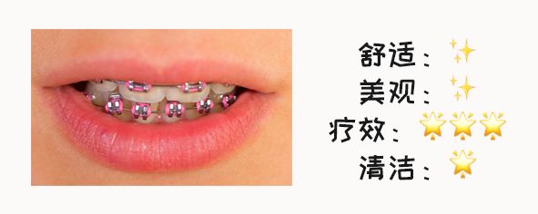 牙套价格表哪种牙套简单又好,最便宜的牙套是哪种牙套