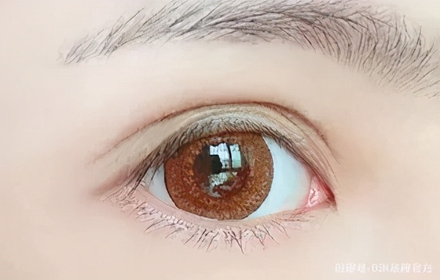 多层眼皮是如何修复的,多层眼皮该怎么消除