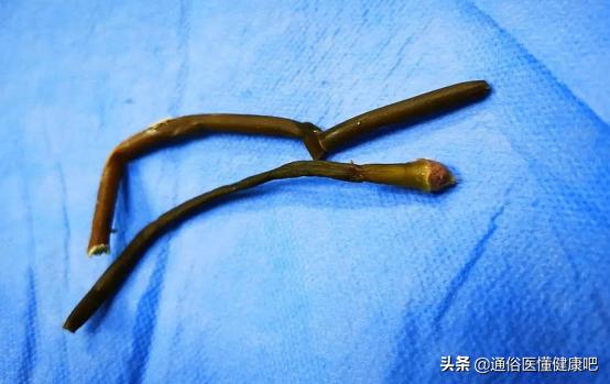 青少年有血尿怎么回事,青少年突然尿血和便血是怎么回事